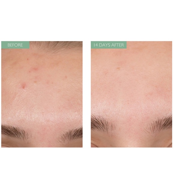 Caudalie Vinopure Natural Salicylic Acid Pore - Picture 6 of 7